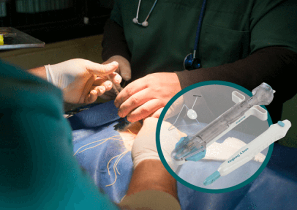 Proximal Seal System