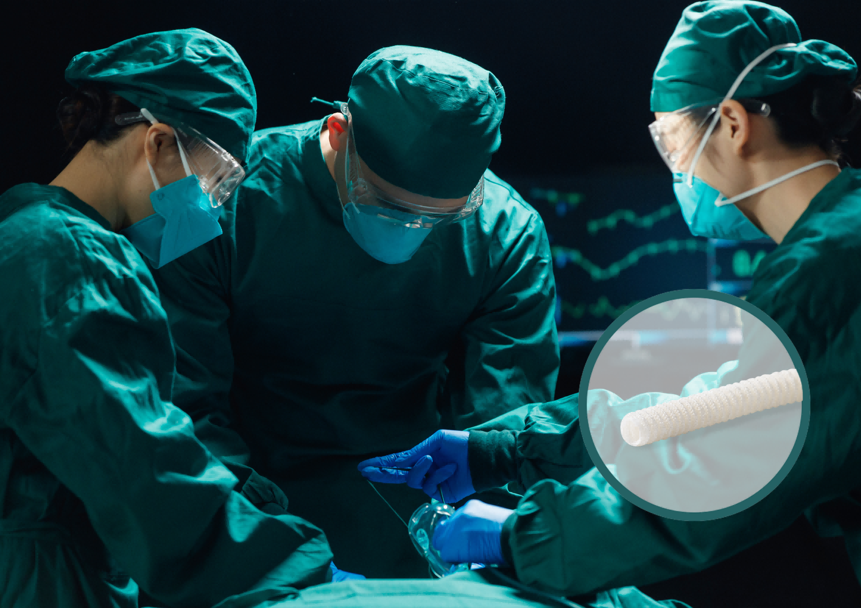 Absorbable Peripheral Nerve Repair Conduit