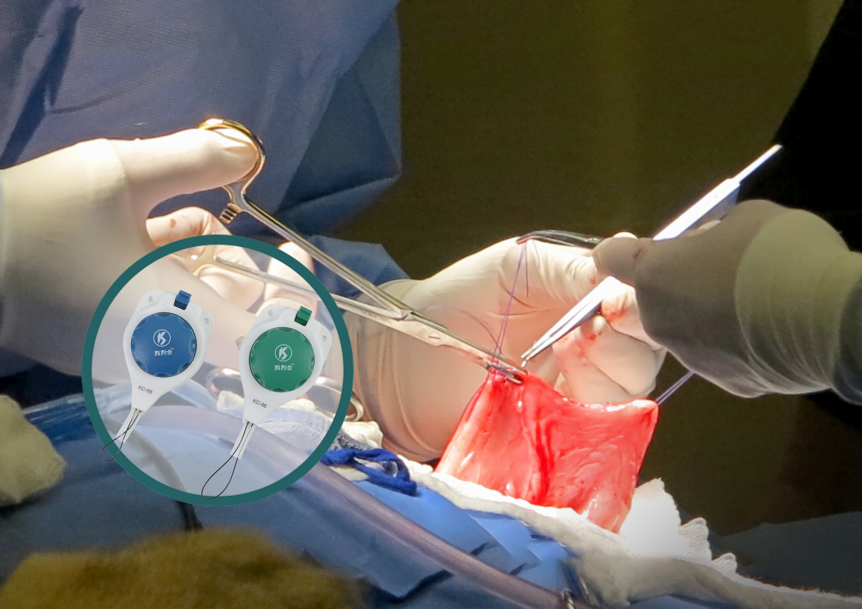 Tension Controlled Dermal Closure Device