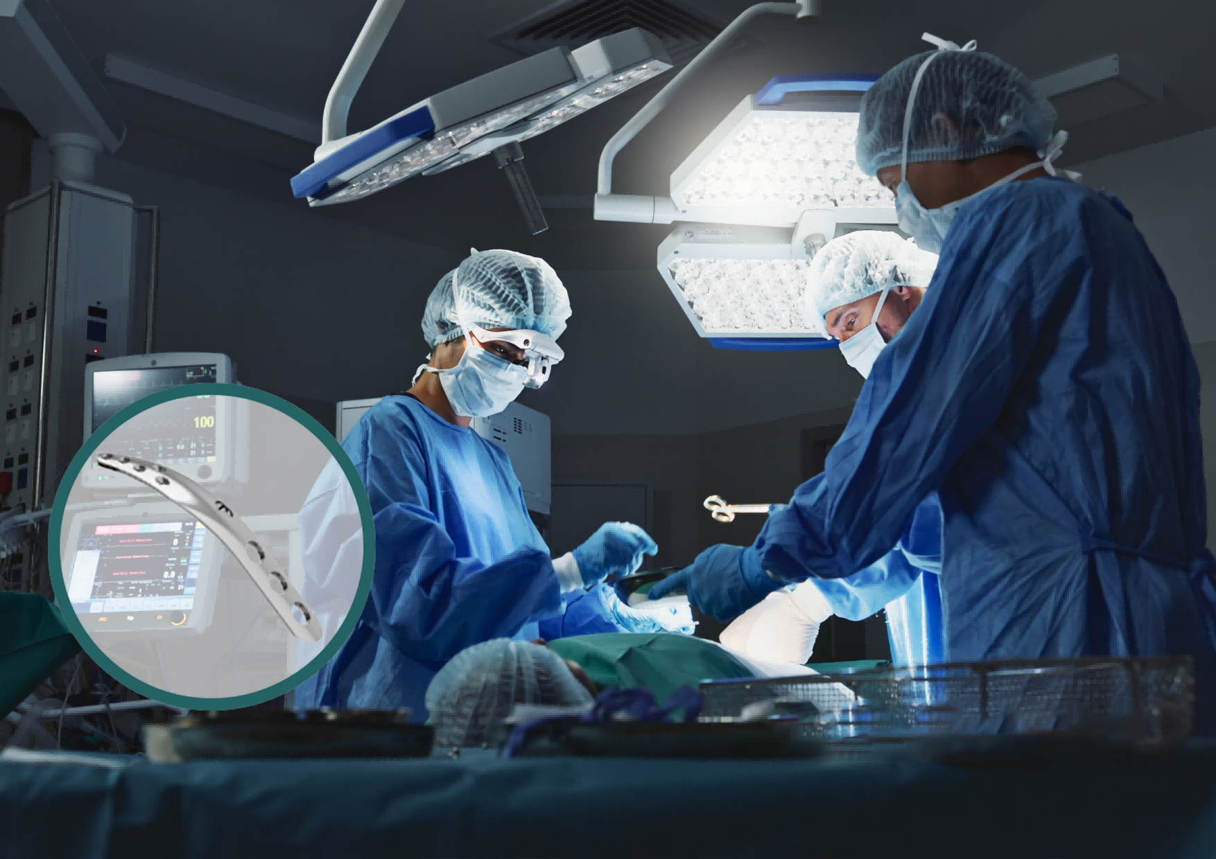 Periarticular fracture bone fragment specific fixation series